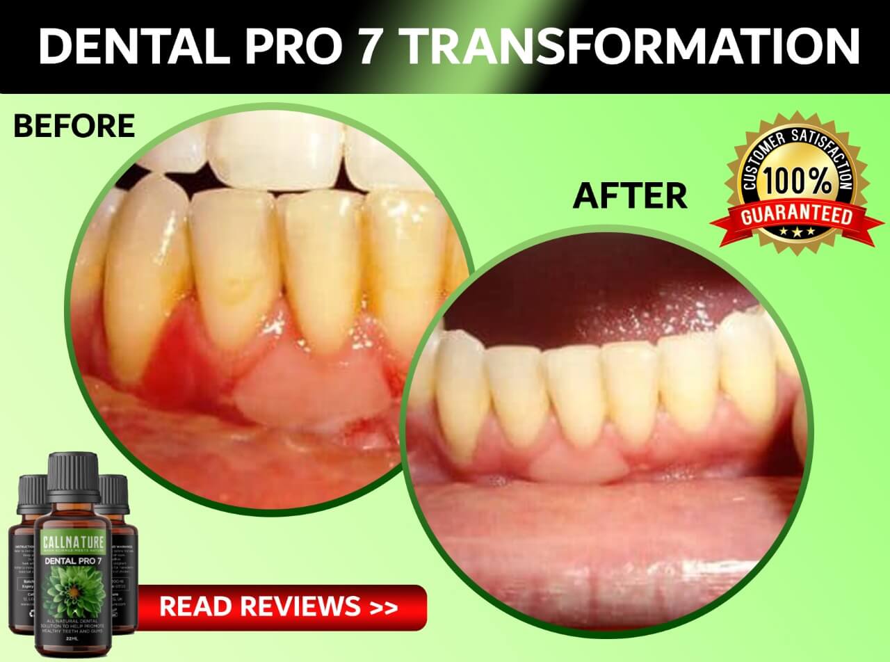 Dental Pro 7 Transformation